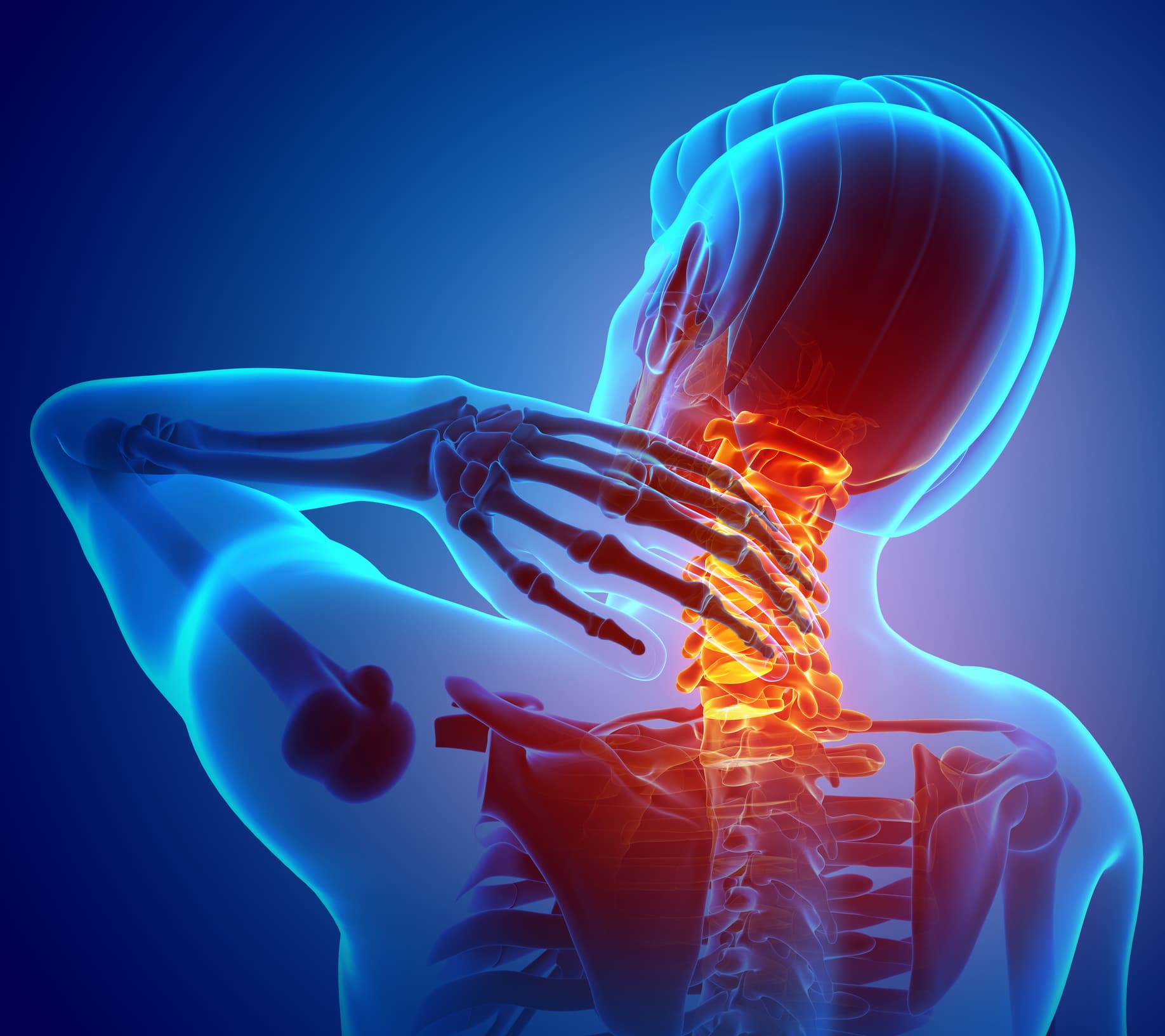 Lesion en el cuello y dolor despues de un accidente
